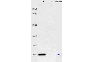 Lane 1: mouse lung lysates Lane 2: mouse muscle lysates probed with Anti Caveolin-1 Polyclonal Antibody, Unconjugated (ABIN686752) at 1:200 in 4 °C. (Caveolin-1 Antikörper  (AA 2-120))