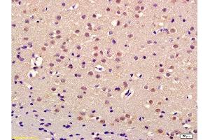 Formalin-fixed and paraffin embedded rat brain labeled with Anti-Thrap3/TRAP150 Polyclonal Antibody, Unconjugated  at 1:200 followed by conjugation to the secondary antibody and DAB staining (THRAP3 Antikörper  (AA 631-730))