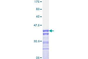 Image no. 1 for Forkhead Box O3 (FOXO3) (AA 361-460) protein (GST tag) (ABIN1354385) (FOXO3 Protein (AA 361-460) (GST tag))