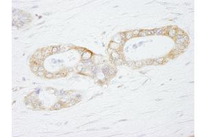 Immunohistochemistry (IHC) image for anti-Ubiquitin Specific Peptidase 3 (USP3) (AA 471-521) antibody (ABIN7449030) (USP3 Antikörper  (AA 471-521))