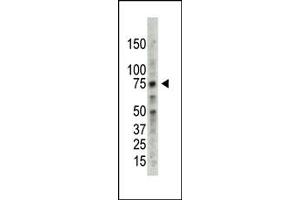 Western Blotting (WB) image for anti-Protein Arginine Methyltransferase 5 (PRMT5) (C-Term) antibody (ABIN356529) (PRMT5 Antikörper  (C-Term))