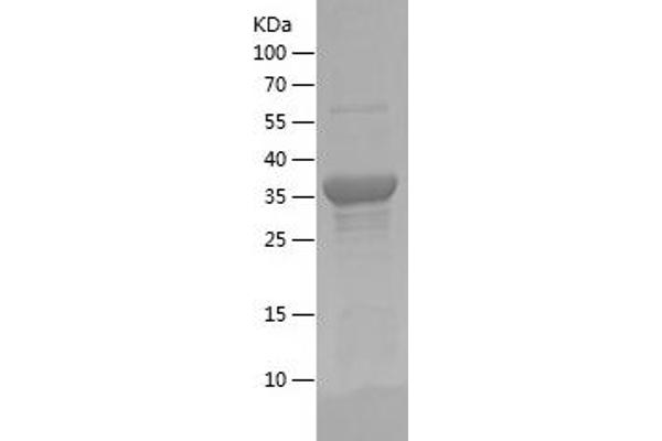 DAB2 Protein (AA 350-450) (His-IF2DI Tag)