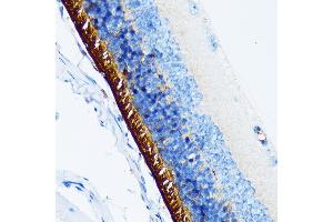 Immunohistochemistry of paraffin-embedded mouse retina using Rhodopsin Rabbit mAb (ABIN7269974) at dilution of 1:100 (40x lens). (Rho-related GTP-binding protein Antikörper)