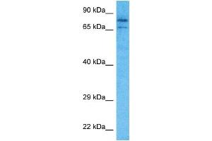 Host:  Rabbit  Target Name:  PRPF3  Sample Type:  MCF7 Whole Cell lysates  Antibody Dilution:  1.