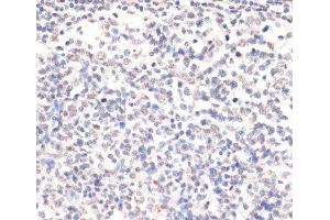 Immunohistochemistry of paraffin-embedded Human placenta using Phospho-Jak2(Y1007/1008) Polyclonal Antibody at dilution of 1:200 (40x lens). (JAK2 Antikörper  (pTyr1007, pTyr1008))