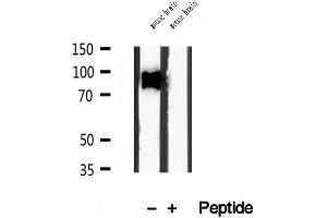 Western blot analysis of extracts of mouse brain tissue, using SEC5/EXOC2 antibody. (EXOC2 Antikörper  (N-Term))