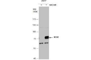 WB Image BCHE antibody detects BCHE protein by western blot analysis. (Butyrylcholinesterase Antikörper)
