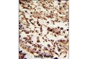 Formalin-fixed and paraffin-embedded human testis tissue reacted with TBP Antibody (C-term), which was peroxidase-conjugated to the secondary antibody, followed by DAB staining. (TBP Antikörper  (C-Term))