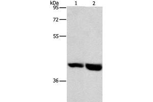 Western Blot analysis of Mouse heart and liver tissue using GPR182 Polyclonal Antibody at dilution of 1:1000 (G Protein-Coupled Receptor 182 Antikörper)