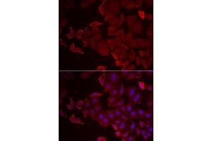 Immunofluorescence analysis of U2OS cell using MARCKSL1 antibody.