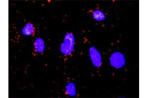 Proximity Ligation Analysis of protein-protein interactions between GSK3B and FOXO1. (FOXO1 Antikörper  (AA 556-655))