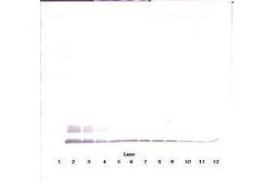 Image no. 3 for anti-Chemokine (C-C Motif) Ligand 8 (CCL8) antibody (ABIN465585) (CCL8 Antikörper)