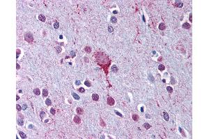 Anti-LPAR4 / GPR23 antibody IHC of human brain, cortex. (LPAR4 Antikörper  (C-Term))