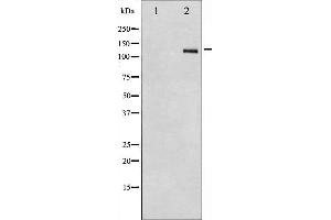 Western blot analysis of Integrin beta3 expression in HepG2 whole cell lysates,The lane on the left is treated with the antigen-specific peptide. (Integrin beta 3 Antikörper  (C-Term))