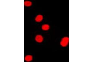 Immunofluorescent analysis of DLX5 staining in Raw264. (DLX5 Antikörper  (Center))