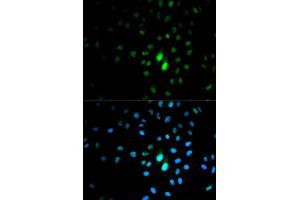 Immunofluorescence analysis of MCF-7 cells using PIN1 antibody. (PIN1 Antikörper  (AA 1-163))