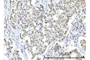 IHC analysis of RBM22 using anti-RBM22 antibody (ABIN7600268). (RBM22 Antikörper  (AA 17-406))