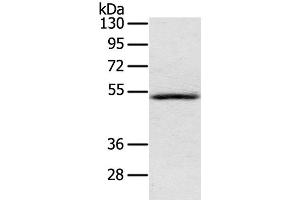 Western Blot analysis of Human normal liver tissue using IL17RB Polyclonal Antibody at dilution of 1:200 (IL17 Receptor B Antikörper)