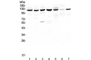 Western blot testing of PARP antibody and Lane 1:  COLO320 (PARP1 Antikörper  (AA 670-858))