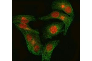 IF analysis of EZH1 using anti-EZH1 antibody (ABIN7601019) and anti-Tubulin Alpha antibody (ABIN7600339).