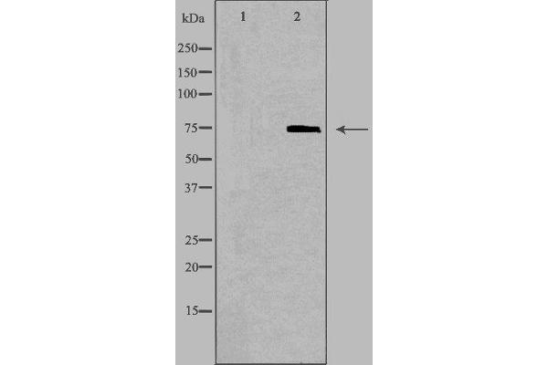 ABCD1 Antikörper  (Internal Region)