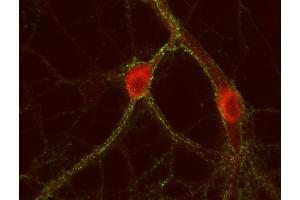 Indirect immunostaining of PFA fixed rat hippocampus neurons with anti-cytohesin 3 (dilution 1 : 500; red) and mouse anti-synapsin 1 (, dilution 1 : 500; green). (Cytohesin 3 Antikörper  (AA 1-70))