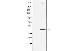 Western blot analysis of S6 Ribosomal Protein expression in serum treated 293 whole cell lysates,The lane on the left is treated with the antigen-specific peptide.