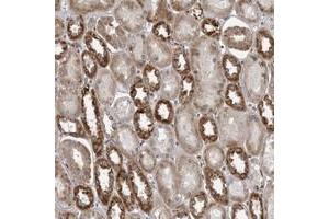 Immunohistochemical staining of human kidney with C17orf70 polyclonal antibody  shows strong cytoplasmic positivity in proximal tubules at 1:50-1:200 dilution. (C17orf70 Antikörper)
