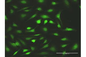 Immunofluorescence of purified MaxPab antibody to FANCC on HeLa cell. (FANCC Antikörper  (AA 1-558))