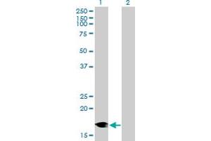 DCTN3 Antikörper  (AA 1-176)