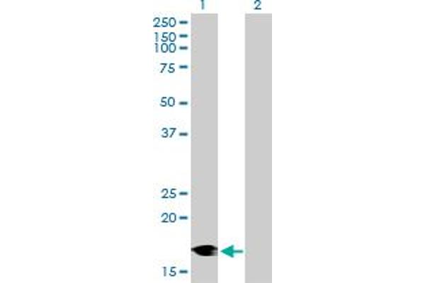 DCTN3 Antikörper  (AA 1-176)