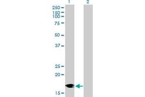 Western Blot analysis of DCTN3 expression in transfected 293T cell line by DCTN3 MaxPab polyclonal antibody. (DCTN3 Antikörper  (AA 1-176))