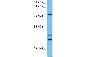 Host:  Mouse  Target Name:  KIF23  Sample Tissue:  Mouse Testis  Antibody Dilution:  1ug/ml (KIF23 Antikörper  (N-Term))