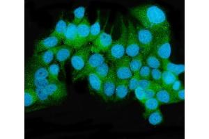 IF analysis of MEK2/MAP2K2 using anti-MEK2/MAP2K2 antibody (ABIN7599355).