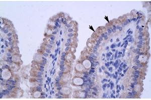 Human Intestine (ZNF358 Antikörper  (N-Term))