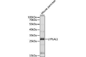 Western blot analysis of extracts of Mouse pancreas, using LYPL antibody (ABIN7268340) at 1:1000 dilution. (LYPLAL1 Antikörper  (AA 1-100))