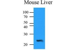Mouse liver lysates (35 ug) were resolved by SDS-PAGE, transferred to PVDF membrane and probed with anti-human NQO2 (1:500).