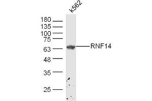 K562 lysates probed with ADAM2 Polyclonal Antibody, Unconjugated  at 1:300 dilution and 4˚C overnight incubation. (ADAM2 Antikörper  (AA 451-550))