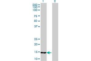 Western Blot analysis of UBE2B expression in transfected 293T cell line by UBE2B monoclonal antibody (M06), clone 4C3. (UBE2B Antikörper  (AA 63-152))
