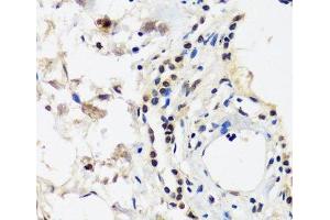 Immunohistochemistry of paraffin-embedded Human lung using CAND1 Polyclonal Antibody at dilution of 1:100 (40x lens). (CAND1 Antikörper)