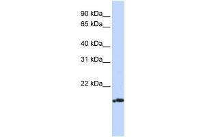 WB Suggested Anti-PLDN Antibody Titration: 0. (Pallidin Antikörper  (Middle Region))