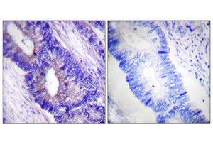 Immunohistochemistry (IHC) image for anti-PKA alpha/beta Cat (pThr197) antibody (ABIN1847296) (PKA alpha/beta Cat (pThr197) Antikörper)