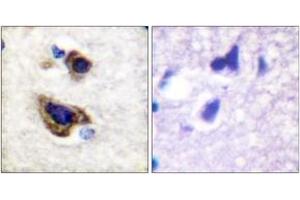 Immunohistochemistry analysis of paraffin-embedded human brain tissue, using GFAP (Ab-38) Antibody. (GFAP Antikörper  (AA 11-60))