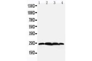 Anti-BAG2 antibody, Western blotting Lane 1: Rat Testis Tissue Lysate Lane 2: HELA Cell Lysate Lane 3: A549 Cell Lysate Lane 4: A431 Cell Lysate