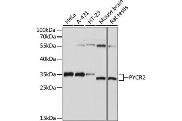 PYCR2 Antikörper  (AA 271-320)
