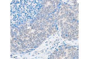 anti-Ubiquitin Specific Peptidase 37 (USP37) (C-Term) antibody