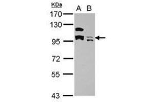 Image no. 3 for anti-Potassium Channel Tetramerisation Domain Containing 19 (KCTD19) (AA 1-162) antibody (ABIN1501897) (KCTD19 Antikörper  (AA 1-162))