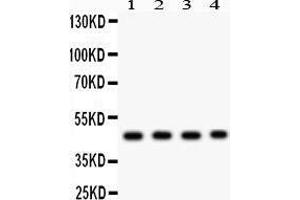 Anti- MBD2 antibody, Western blotting All lanes: Anti MBD2  at 0. (MBD2 Antikörper  (AA 159-411))
