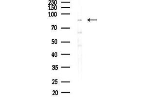 anti-Chromosome 10 Open Reading Frame 28 (C10orf28) (C-Term) antibody
