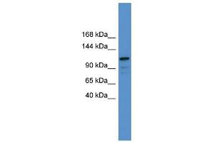 WB Suggested Anti-NFATC1 Antibody Titration:  0. (NFATC1 Antikörper  (C-Term))